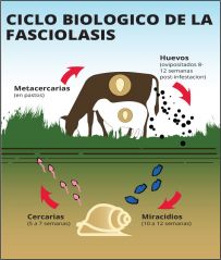 fasciolasis